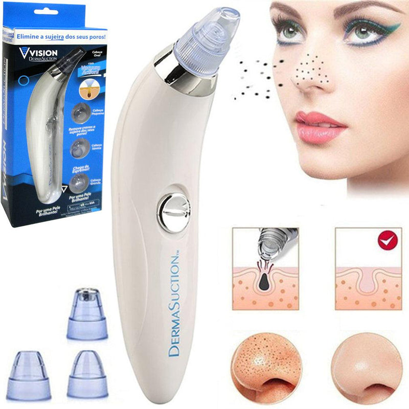 REMOVEDOR FACIAL 4 EM 1 DE CRAVO E ESPINHA DERMA SUCTION A PILHA NA CAIXA